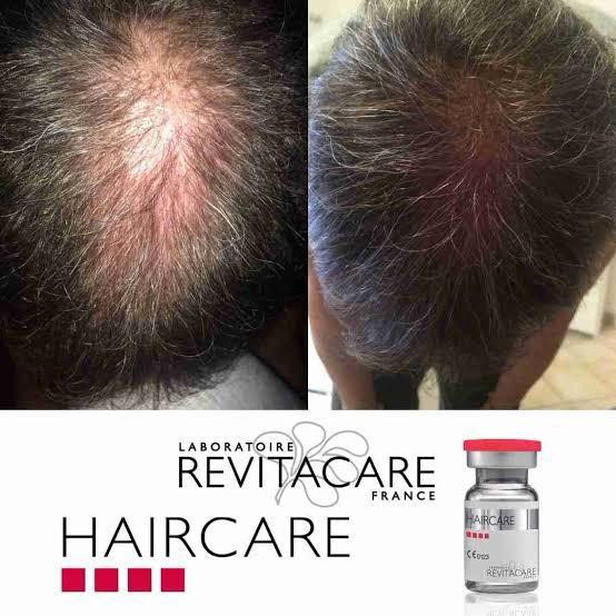 عکس قبل و بعد استفاده از کوکتل رویتاکر هیرکر اصل فرانسه