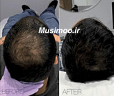 تصویر محصول Fusion F-HAIR MAN اصل اسپانیا